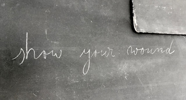 beuys-wound-hamburger-bahnhof-femalegazesite.wordpress.com